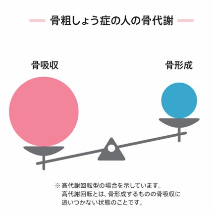 骨粗しょう症の人の骨代謝