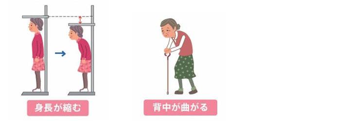 身長が縮む　背中が曲がる